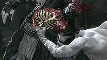 036-cage_sub-xray_torso2.jpg